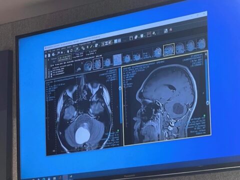 Medical imaging of a brain.